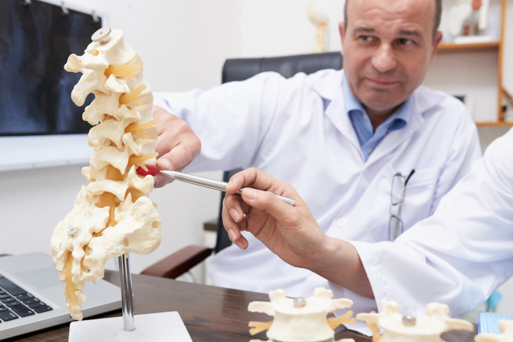Doctor showing model of inflammation in spine. Spine & Disc Degeneration